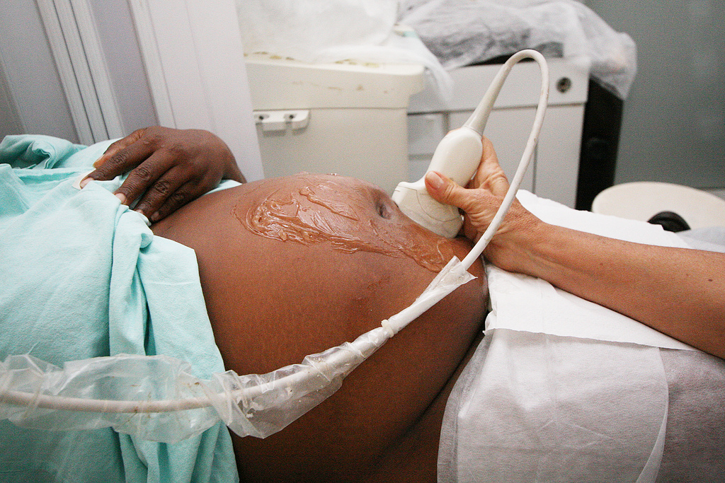 Exame pré-natal feito no IPERBA